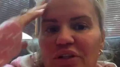 0 Kerry Katonas rib used to rebuild cocaine ravaged nose in gruesome operation - Kerry Katona Mengaku Penuh Kecemasan: Kisah Pengalaman Serangan Panik Parah yang Mencekam