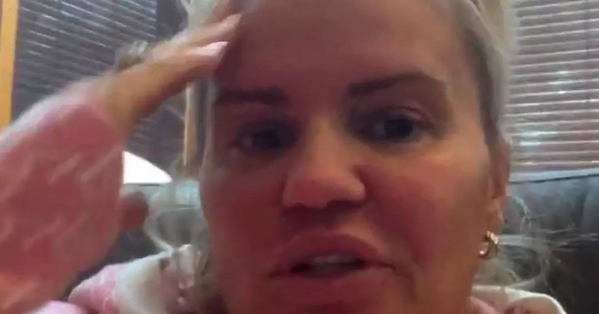 0 Kerry Katonas rib used to rebuild cocaine ravaged nose in gruesome operation - Kerry Katona Mengaku Penuh Kecemasan: Kisah Pengalaman Serangan Panik Parah yang Mencekam