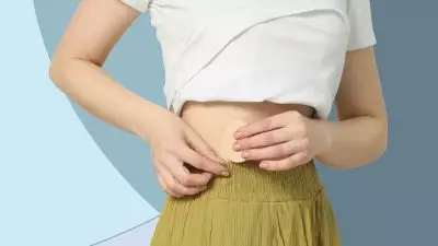 Apakah Perawatan Kulit Menggunakan Vitamin Patch Efektif? Rasakan Manfaatnya Sekarang!